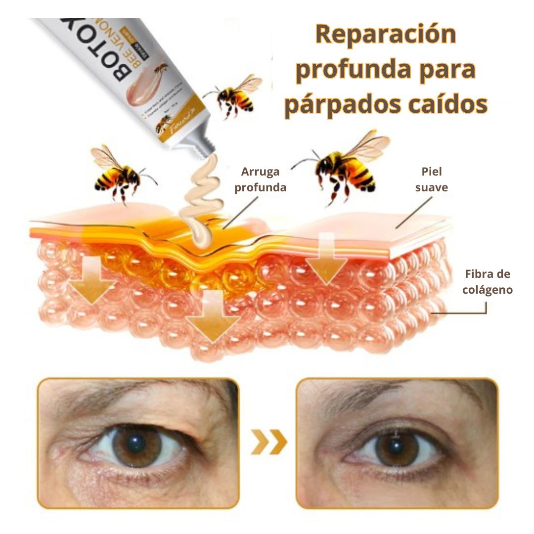 Botox Bee Venom