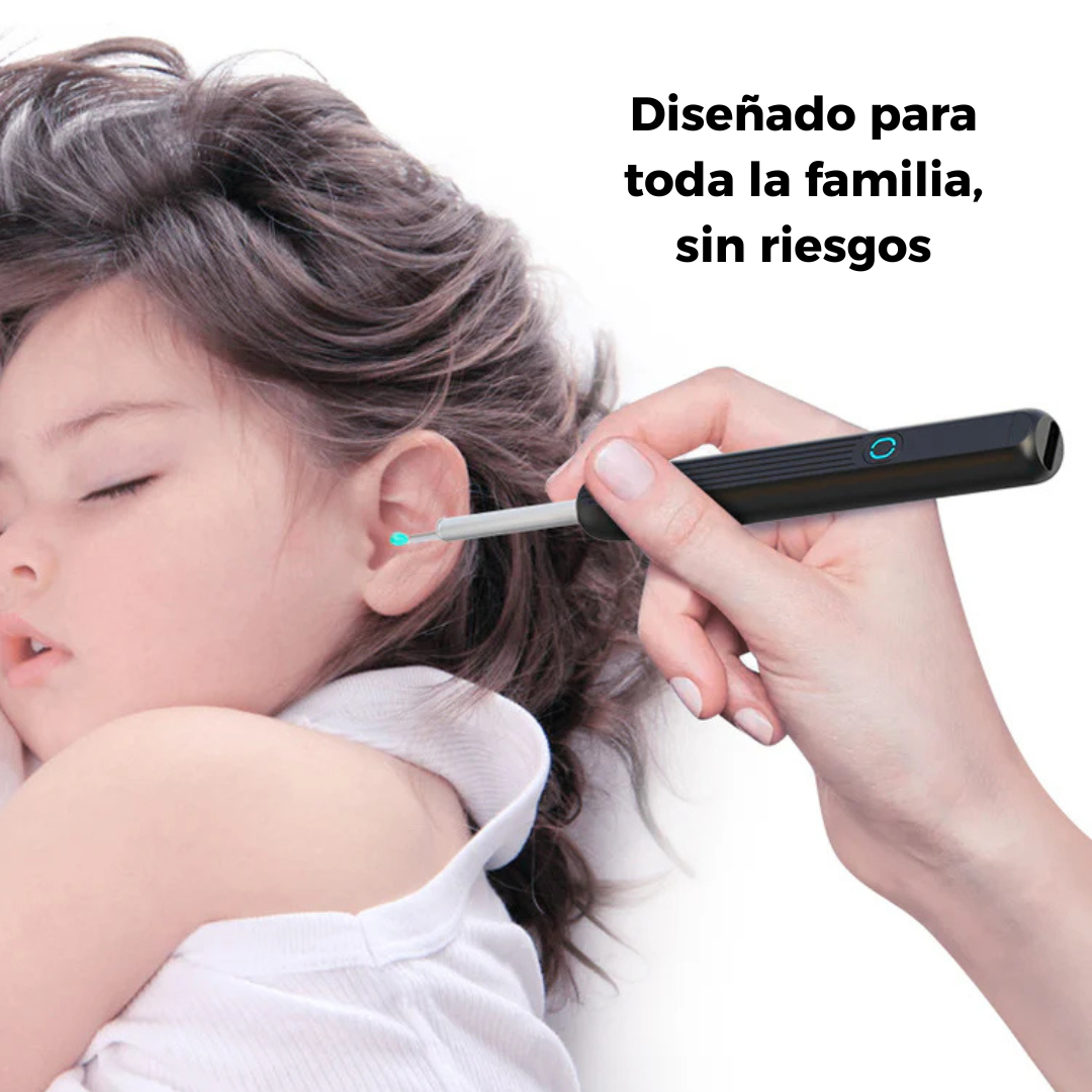 OtoView™ – Limpieza de Oídos con Cámara HD