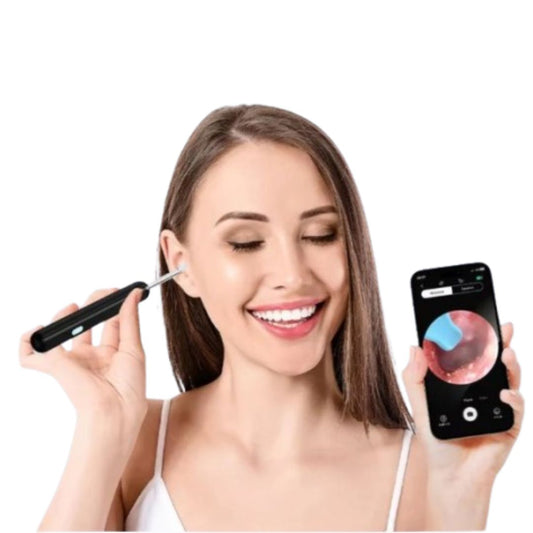 OtoView™ – Limpieza de Oídos con Cámara HD