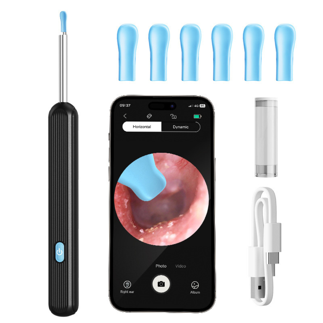 OtoView™ – Limpieza de Oídos con Cámara HD