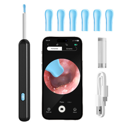 OtoView™ – Limpieza de Oídos con Cámara HD