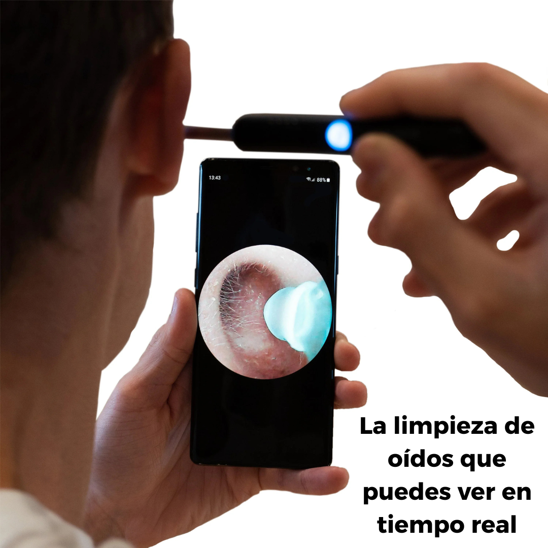 OtoView™ – Limpieza de Oídos con Cámara HD